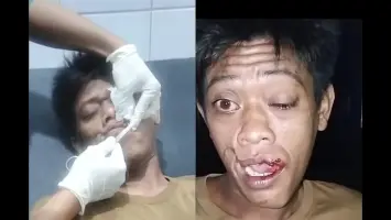 Lakukan Tindakan Kekerasan Hingga Sebabkan Luka, Tomo di Laporkan ke Mapolsek Katibung